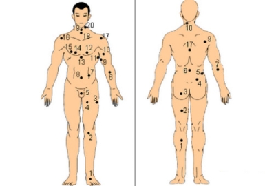 8 loại nốt ruồi may mắn giúp bạn thường gặp quý nhân khi khó khăn